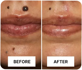 NutriDerma Guard Reviews 3